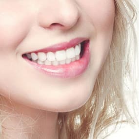 Patients ask: can veneers repair my chipped teeth?