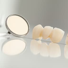 Dental Practice Provides Crowns, Bridges, and Dental Crown Restoration In Calgary