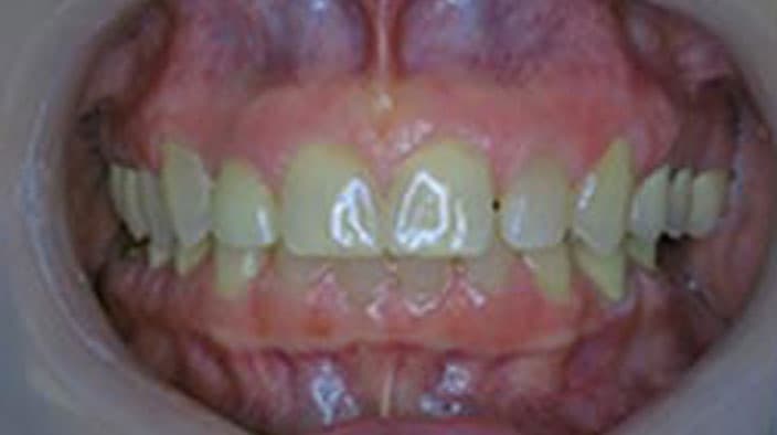 Biobloc Orthotropics — after