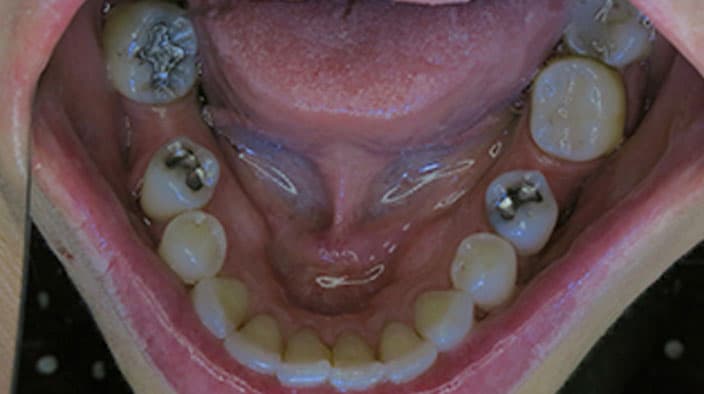 Biological Dentistry — before